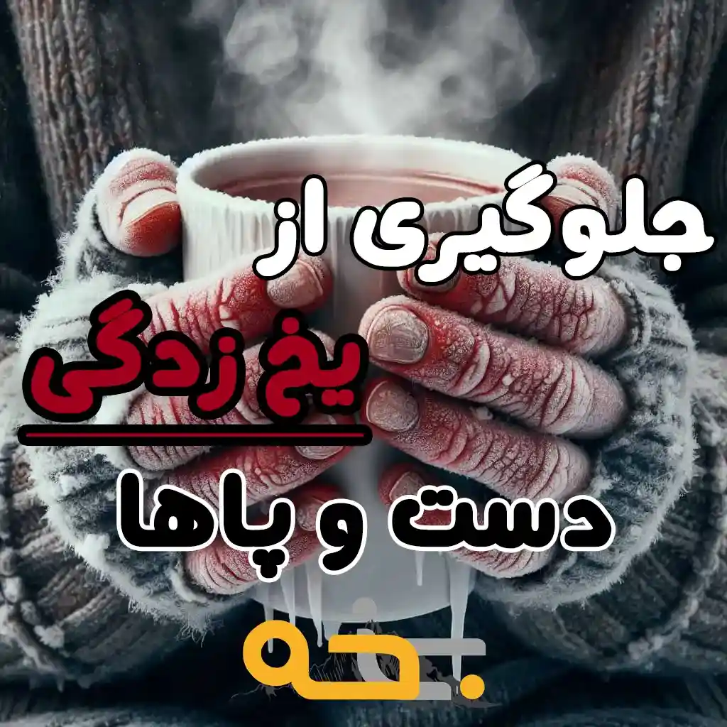 نحوه جلوگیری و رفع یخ زدگی دست و پا